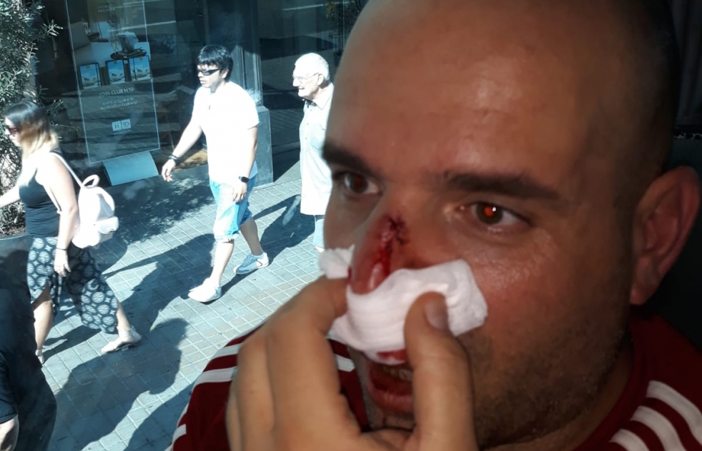 Un polica nacional de la comisara de Alcal sufre una salvaje agresin en Barcelona. (Incluye vdeo)